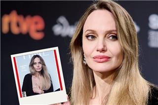 Η Αντζελίνα Τζολί αποκαλύπτει την ουλή της διπλής μαστεκτομής για πρώτη φορά