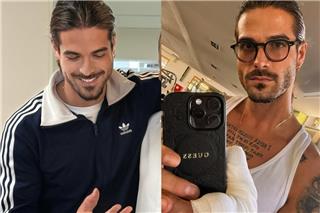 Αρης Μουγκοπέτρος: Δείχνει για πρώτη φορά τα δύο πρόσθετα δάχτυλα μετά τον ακρωτηριασμό του