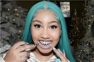 Κιμ Καρντάσιαν: Η 12χρονη κόρη της πόζαρε με μπλε μαλλιά, μακριά νύχια και διαμαντένια οδοντοστοιχία