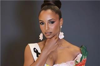 Με εγκεφαλική αιμορραγία η Μις Τζαμάικα - Δίνει μάχη για τη ζωή της