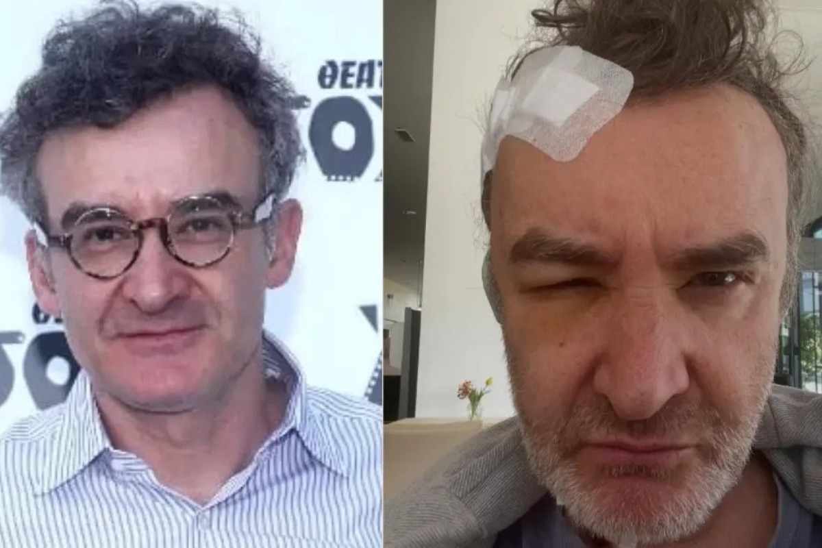 Νίκος Ορφανός: «Είχα όγκο στο κεφάλι» – Τι είναι το κρανιοφαρυγγίωμα για το οποίο έκανε επέμβαση στη Γερμανία
