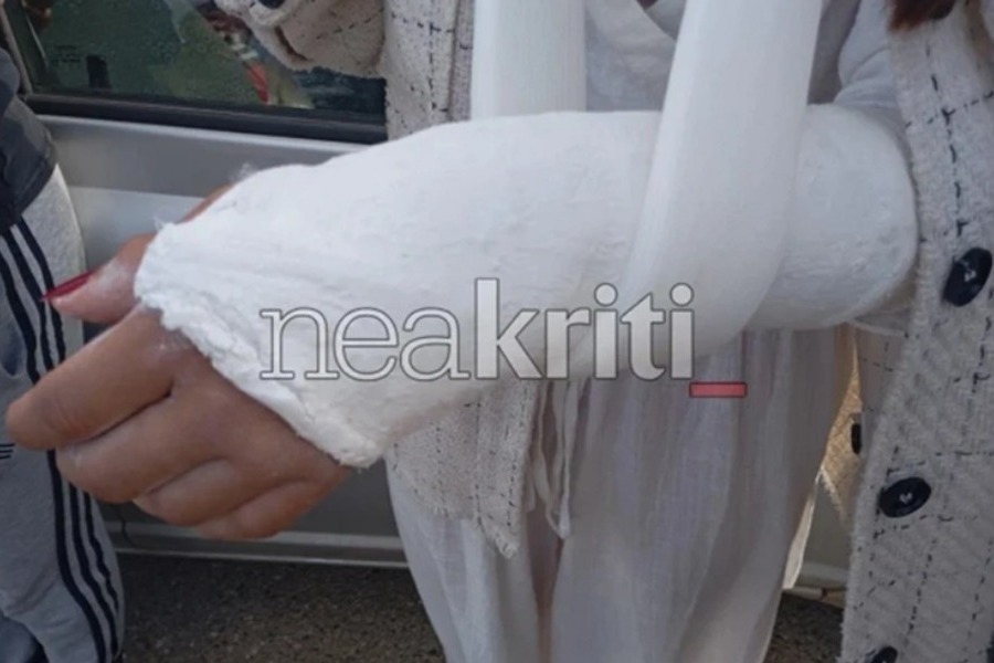 «Αν χτυπούσε εμένα, θα είχα σκοτωθεί»: Συγκλονίζει η 25χρονη που παρασύρθηκε στην Κρήτη – Νεκρό το σκυλάκι της