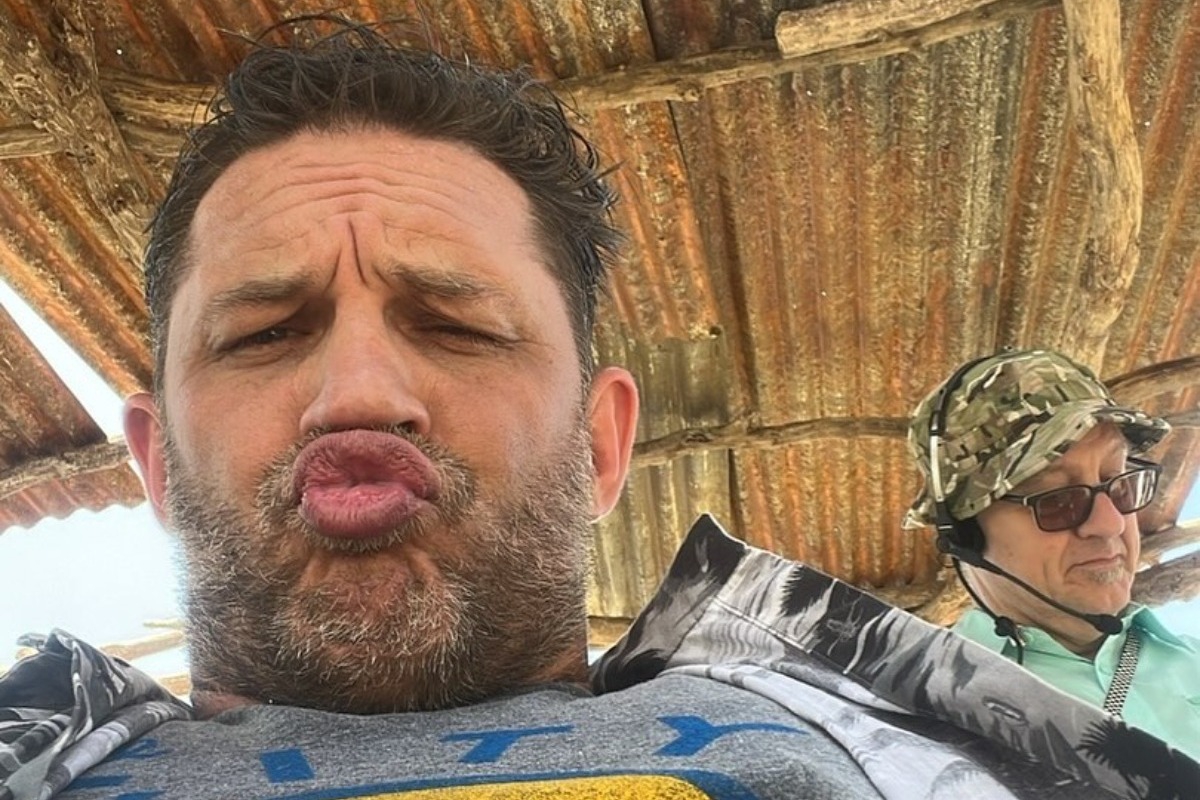 Καταρρέει ο Tom Hardy; Όλα τα προβλήματα υγείας που δεν ήξερες ότι τον βασανίζουν