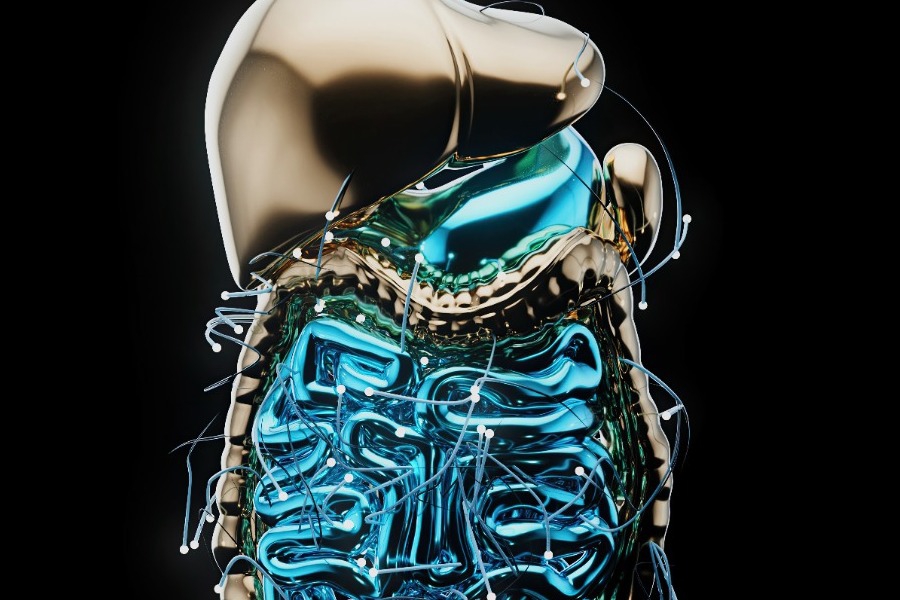 Τι είναι ο αποφρακτικός ειλεός με τον οποίο διαγνώστηκε η Μαρέβα Γκραμπόφσκι‑Μητσοτάκη