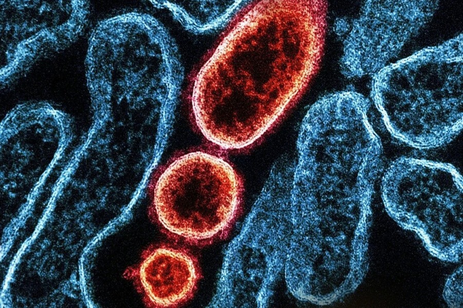 Ιός Nipah: Έχει θνησιμότητα 40 με 50 τοις εκατό ‑ Ποιες οι πιθανότητες να φτάσει στην Ελλάδα