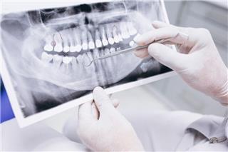 Τι πάθηση έχει ο άνθρωπος με τα περισσότερα δόντια στον κόσμο