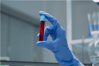 Σήμερα έμαθα: Η ομάδα αίματος που έχουν μόνο 50 άνθρωποι στον πλανήτη