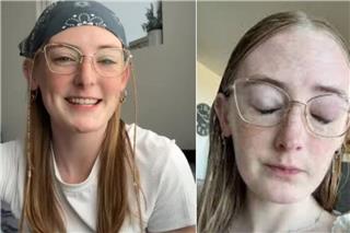 Έκανε μπάνιο με τους φακούς επαφής και έχασε την όρασή της μέσα σε λίγες μέρες