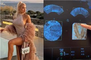 Ιωάννα Τούνη: Έδειξε τον υπέρηχο και έγινε χαμός – Πώς απάντησε στις φήμες εγκυμοσύνης