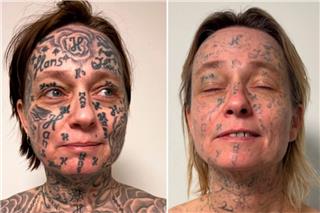 Απίστευτη κακοποίηση στην Ολλανδία: Έκανε τατουάζ 250 φορές το όνομά του στο κορμί της κοπέλας του