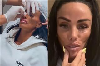 Κέιτι Πράις: «Έχω παραμορφωθεί» – Δυσκολεύεται να μιλήσει μετά την τελευταία επέμβαση