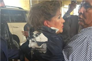 Σοκ: Πέταξαν εκρηκτικό μηχανισμό στο κεφάλι βουλευτή έξω από το Κοινοβούλιο της Ονδούρας