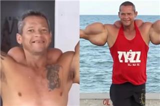 Πέθανε ο «Ποπάι» της Βραζιλίας, με τα μπράτσα μεγαλύτερα από το κεφάλι του