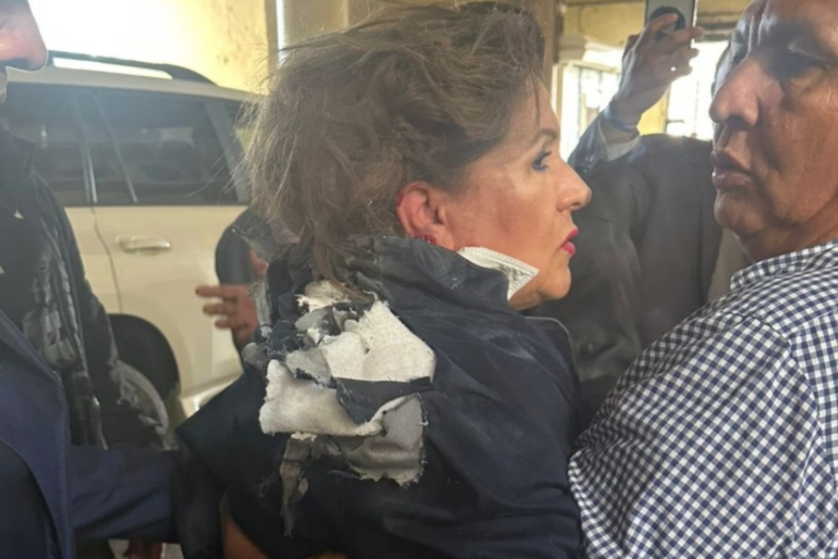 Σοκ: Πέταξαν εκρηκτικό μηχανισμό στο κεφάλι βουλευτή έξω από το Κοινοβούλιο της Ονδούρας