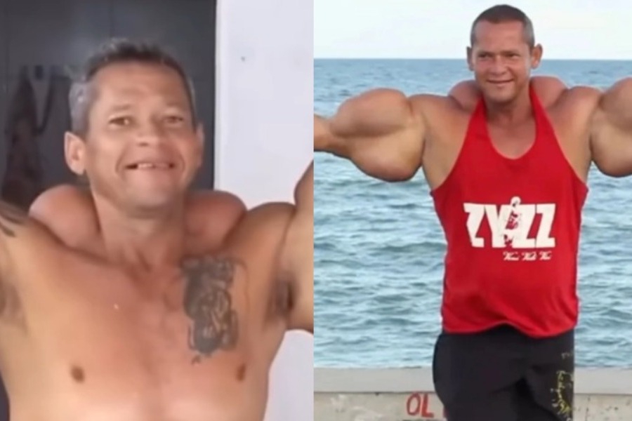 Πέθανε ο «Ποπάι» της Βραζιλίας, με τα μπράτσα μεγαλύτερα από το κεφάλι του