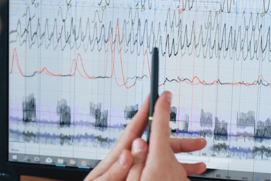 Ευθύμης Λέκκας ‑ Σεισμός: «Στο Αγιο Όρος έχουμε έναν επιστημονικό γρίφο»